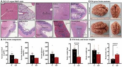 Early Influences of Microbiota on White Matter Development in Germ-Free Piglets